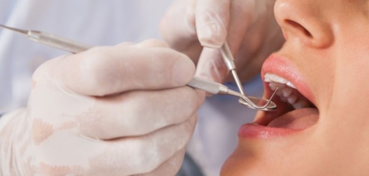 Parodontitis: Eine tückische Bakterieninfektion des Zahnfleisches | Zahnarztpraxis Dr- Pink | Dr. Wolferstätter | Kollegen