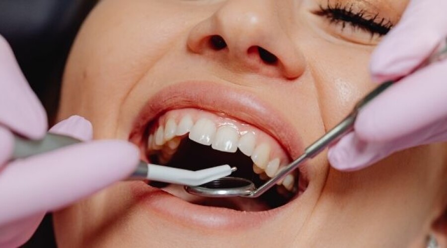 Zahnkronen: Vor- und Nachteile